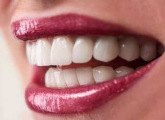 implant diş estetiği