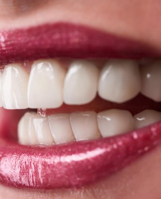 implant diş estetiği