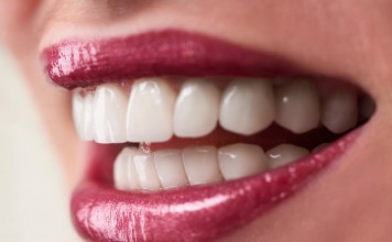 implant diş estetiği