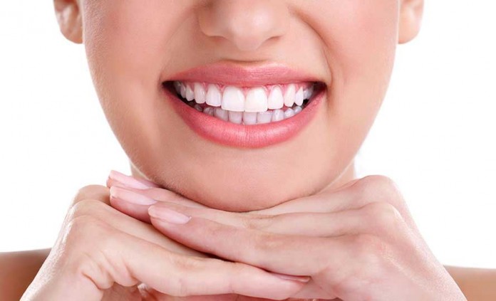 Bonding Diş Tedavisi Nedir